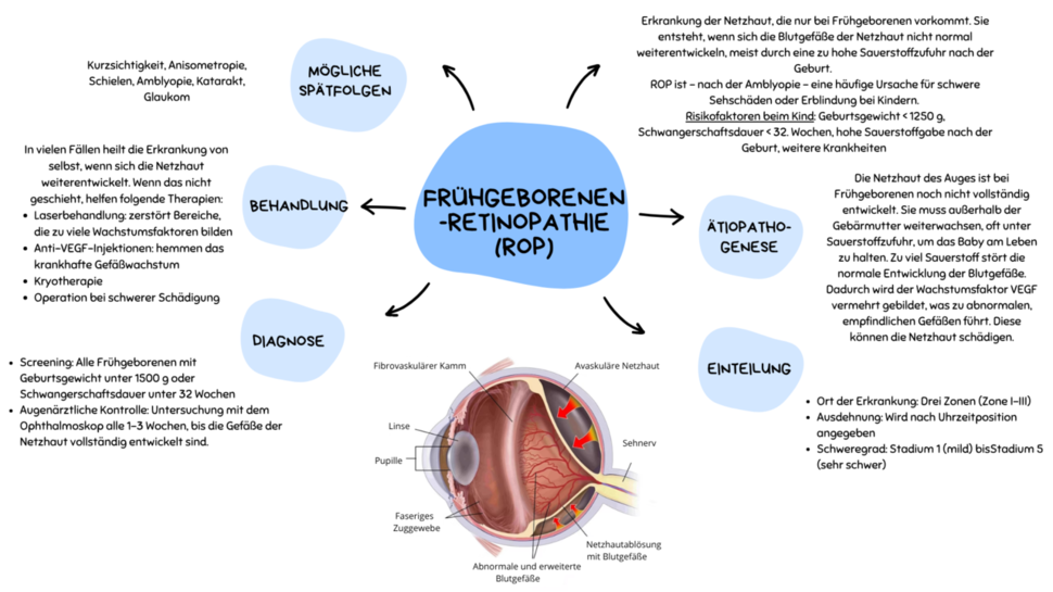 Grafik: Frühgeborenenretinopathie (ROP)