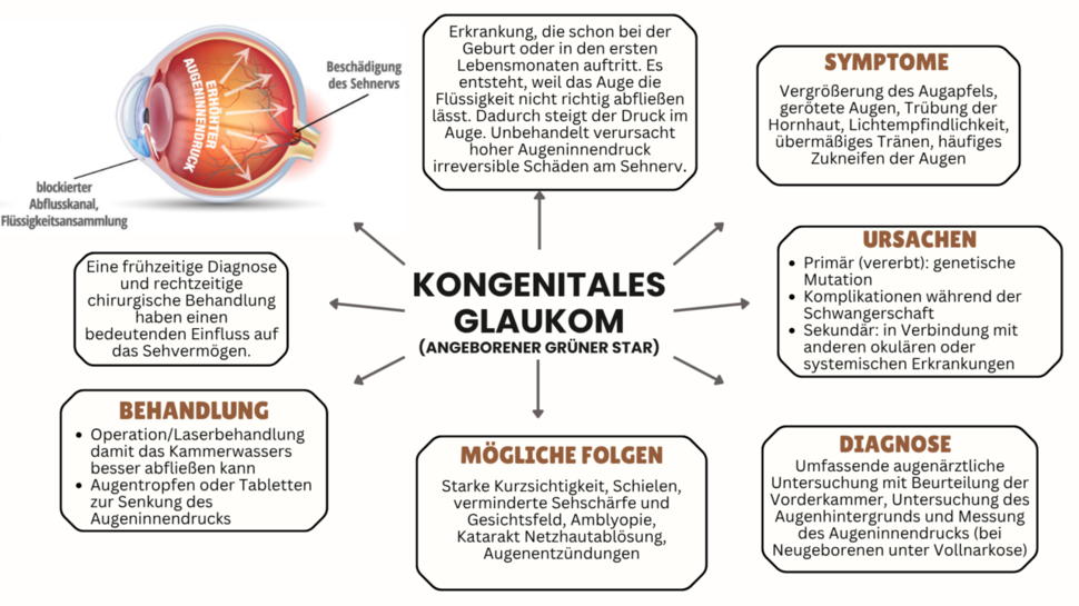 Grafik: Kongenitales Glaukom 